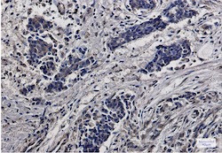 RPS6 Antibody in Immunohistochemistry (Paraffin) (IHC (P))