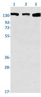 ROCK1 Antibody in Western Blot (WB)