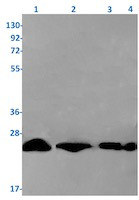 UQCRFS1 Antibody in Western Blot (WB)