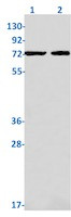 RIPK1 Antibody in Western Blot (WB)