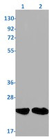 RAC3 Antibody in Western Blot (WB)