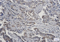RAB7A Antibody in Immunohistochemistry (Paraffin) (IHC (P))
