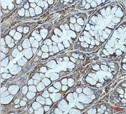 RAB7A Antibody in Immunohistochemistry (Paraffin) (IHC (P))