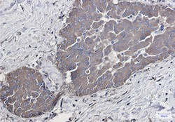 RAB5A Antibody in Immunohistochemistry (Paraffin) (IHC (P))