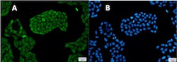 PSMC5 Antibody in Immunocytochemistry (ICC/IF)