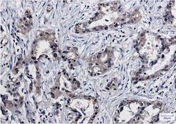 PSMB10 Antibody in Immunohistochemistry (Paraffin) (IHC (P))