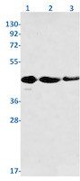 PRKAR1A Antibody in Western Blot (WB)