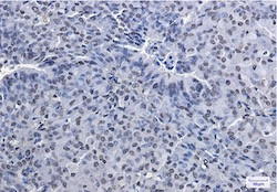 PRMT1 Antibody in Immunohistochemistry (Paraffin) (IHC (P))
