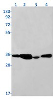 PPP2CA Antibody in Western Blot (WB)
