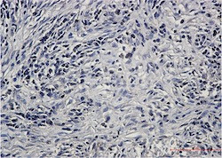 PPP2CA Antibody in Immunohistochemistry (Paraffin) (IHC (P))