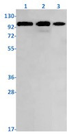 PRKD1 Antibody in Western Blot (WB)