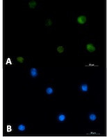 PRKCB Antibody in Immunocytochemistry (ICC/IF)