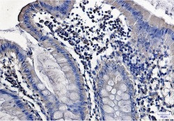 PRKCA Antibody in Immunohistochemistry (Paraffin) (IHC (P))