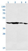 PGK1 Antibody in Western Blot (WB)