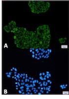PFKP Antibody in Immunocytochemistry (ICC/IF)