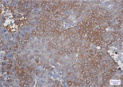 PRDX2 Antibody in Immunohistochemistry (Paraffin) (IHC (P))