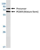 PCSK9 Antibody in Western Blot (WB)