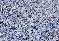 PARP1 Antibody in Immunohistochemistry (Paraffin) (IHC (P))