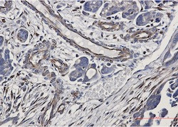 CDH1/CDH2/CDH3 Antibody in Immunohistochemistry (Paraffin) (IHC (P))