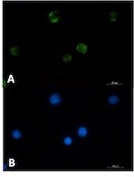 PAK1 Antibody in Immunocytochemistry (ICC/IF)