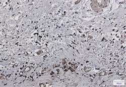 Phospho-PAK1/PAK2/PAK3 (Ser144, Ser141, Ser154) Antibody in Immunohistochemistry (Paraffin) (IHC (P))
