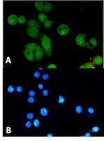 NBN Antibody in Immunocytochemistry (ICC/IF)