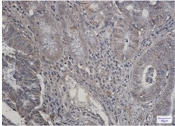 RPS6KB2 Antibody in Immunohistochemistry (Paraffin) (IHC (P))