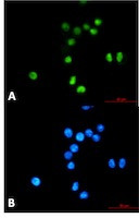 TP53 Antibody in Immunocytochemistry (ICC/IF)