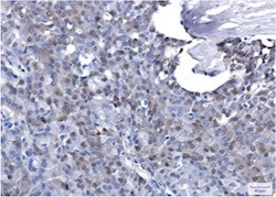 CDKN1B Antibody in Immunohistochemistry (Paraffin) (IHC (P))