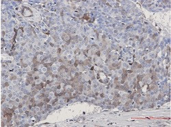 CDKN2C Antibody in Immunohistochemistry (Paraffin) (IHC (P))