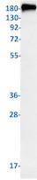 ABCB1 Antibody in Western Blot (WB)