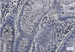 WASL Antibody in Immunohistochemistry (Paraffin) (IHC (P))