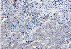 NUMB Antibody in Immunohistochemistry (Paraffin) (IHC (P))