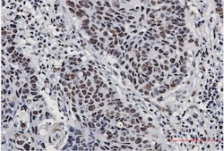 NPM1 Antibody in Immunohistochemistry (Paraffin) (IHC (P))
