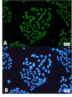 THOC1 Antibody in Immunocytochemistry (ICC/IF)