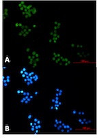 NTHL1 Antibody in Immunocytochemistry (ICC/IF)