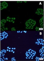 NR1D1 Antibody in Immunocytochemistry (ICC/IF)