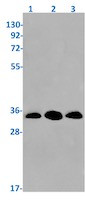 NQO1 Antibody in Western Blot (WB)