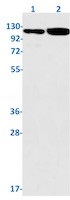 NOTCH1 Antibody in Western Blot (WB)