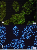 NFKB2 Antibody in Immunocytochemistry (ICC/IF)