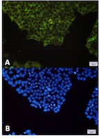 NFKB2 Antibody in Immunocytochemistry (ICC/IF)