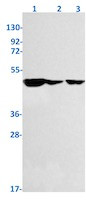 TACR1 Antibody in Western Blot (WB)
