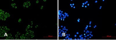 NDUFB4 Antibody in Immunocytochemistry (ICC/IF)
