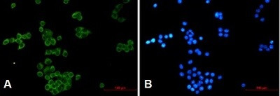 NCK1 Antibody in Immunocytochemistry (ICC/IF)
