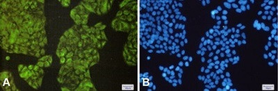 NCK2 Antibody in Immunocytochemistry (ICC/IF)