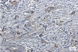 MYO1B Antibody in Immunohistochemistry (Paraffin) (IHC (P))