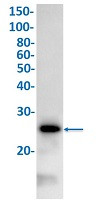 MPZ Antibody in Western Blot (WB)