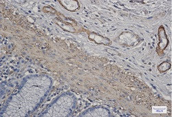 ACTA1 Antibody in Immunohistochemistry (Paraffin) (IHC (P))