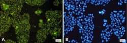 MT-CO2 Antibody in Immunocytochemistry (ICC/IF)