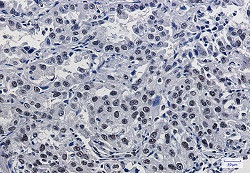 MRE11 Antibody in Immunohistochemistry (Paraffin) (IHC (P))